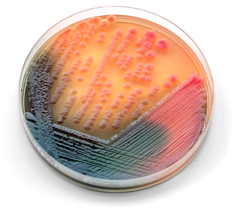 E coli petri dish